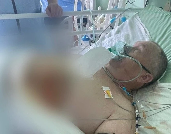 Збір на 200 тисяч гривень: донька пораненого під час атаки на Полтаву Сергія Добридня благає про допомогу